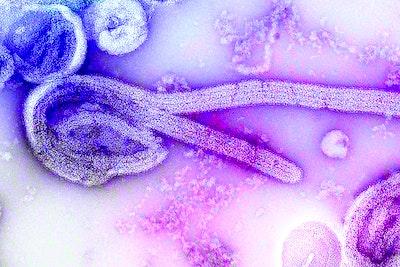Ebola Virus Mikroskop