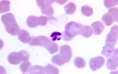Malaria Virus Mikroskop